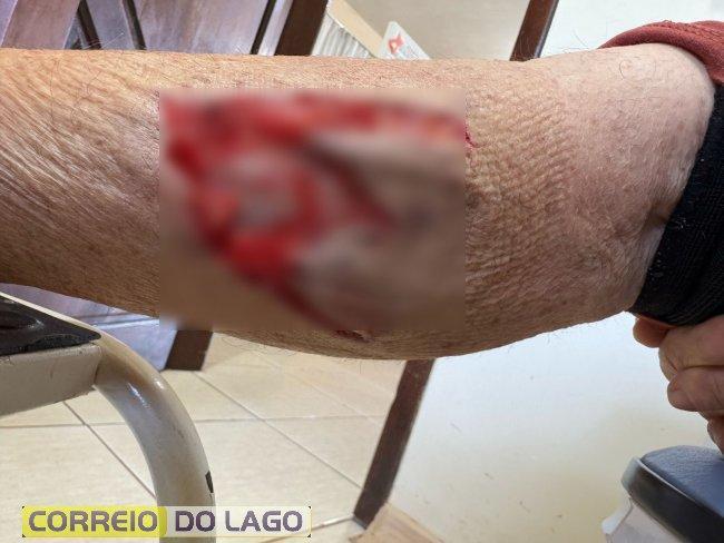 Cão ataca moradores de distrito da região
