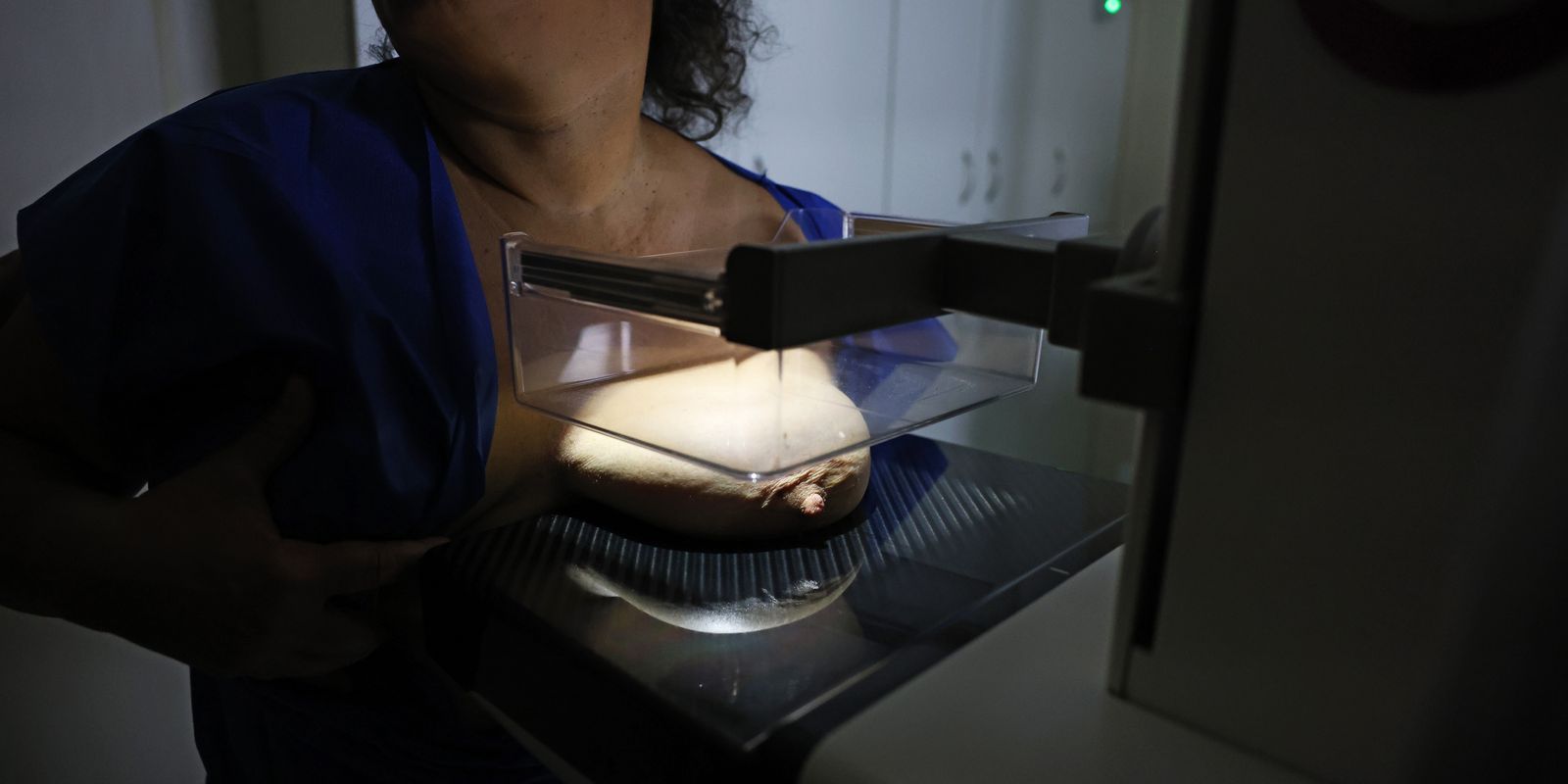 ANS defende que plano cubra mamografia digital sem restrição de idade